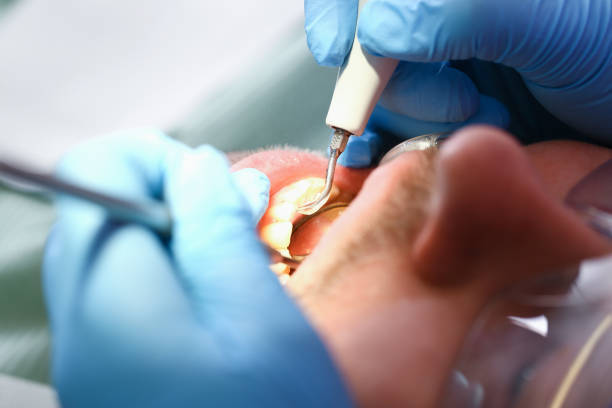 Best Emergency Denture Repair in Spurgeon, TN