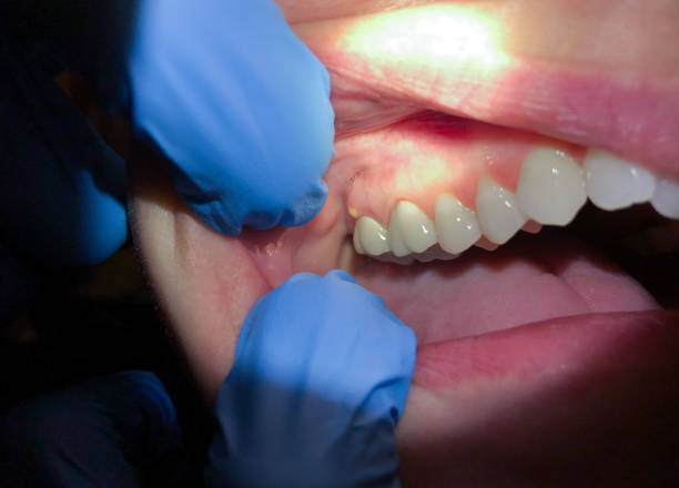 Best Emergency Cosmetic Dentistry (e.g., broken veneers) in Spurgeon, TN